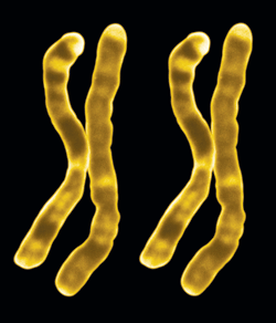 Mayer-Rokitansky-Küster-Hauser syndrome