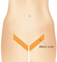 BIKINI LINE