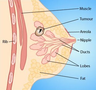 breast pain