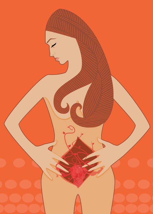 endometiosis
