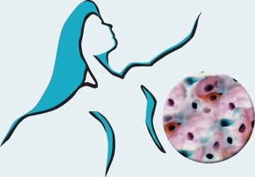 GENITAL HUMAN PAPILLOMAVIRUS (HPV) sexually transmitted 