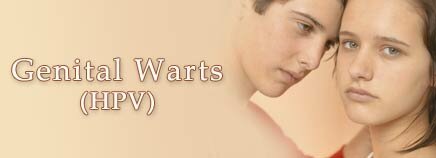 GENITAL WARTS sexually transmitted