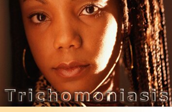 TRICHOMONIASIS sexually transmitted