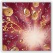 bacterial vaginosis