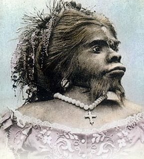 HYPERTRICHOSIS